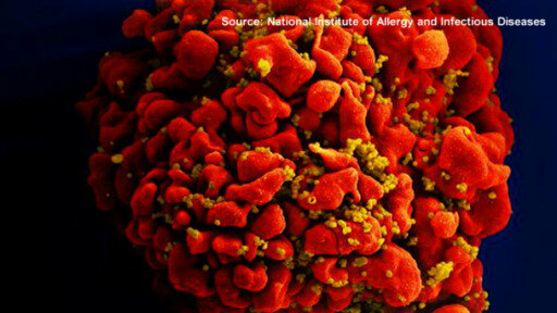 Las investigaciones de ARNm podrían dar el impulso definitivo para hallar un medicamento contra el VIH.