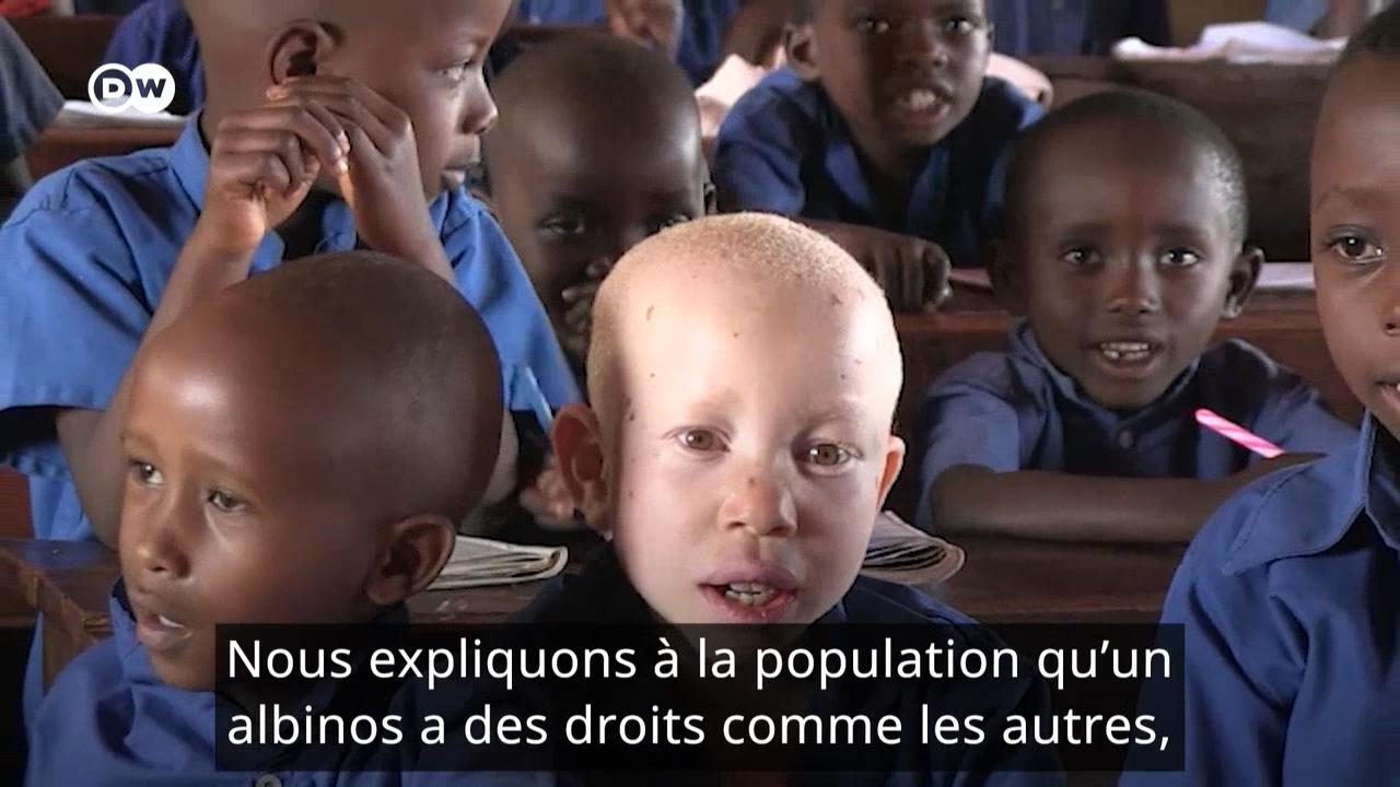 Au Burundi, le combat des albinos pour leurs droits