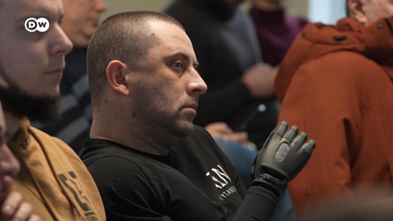 Як європейці протезують українців завдяки остеоінтеграції – DW – 09.01.2026