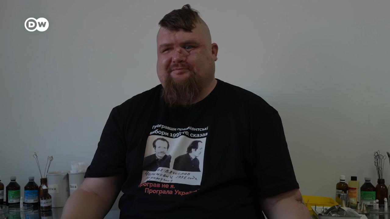 Історія ветерана, який пережив 18 операцій